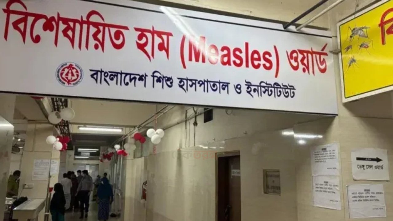 হাম উপসর্গে একদিনে তিনজনের মৃত্যু, স্বাস্থ্য কর্মকর্তারা সতর্ক